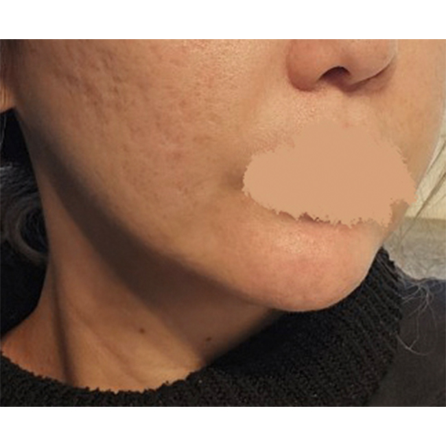 얼지흡받고 쉐딩안합니다~