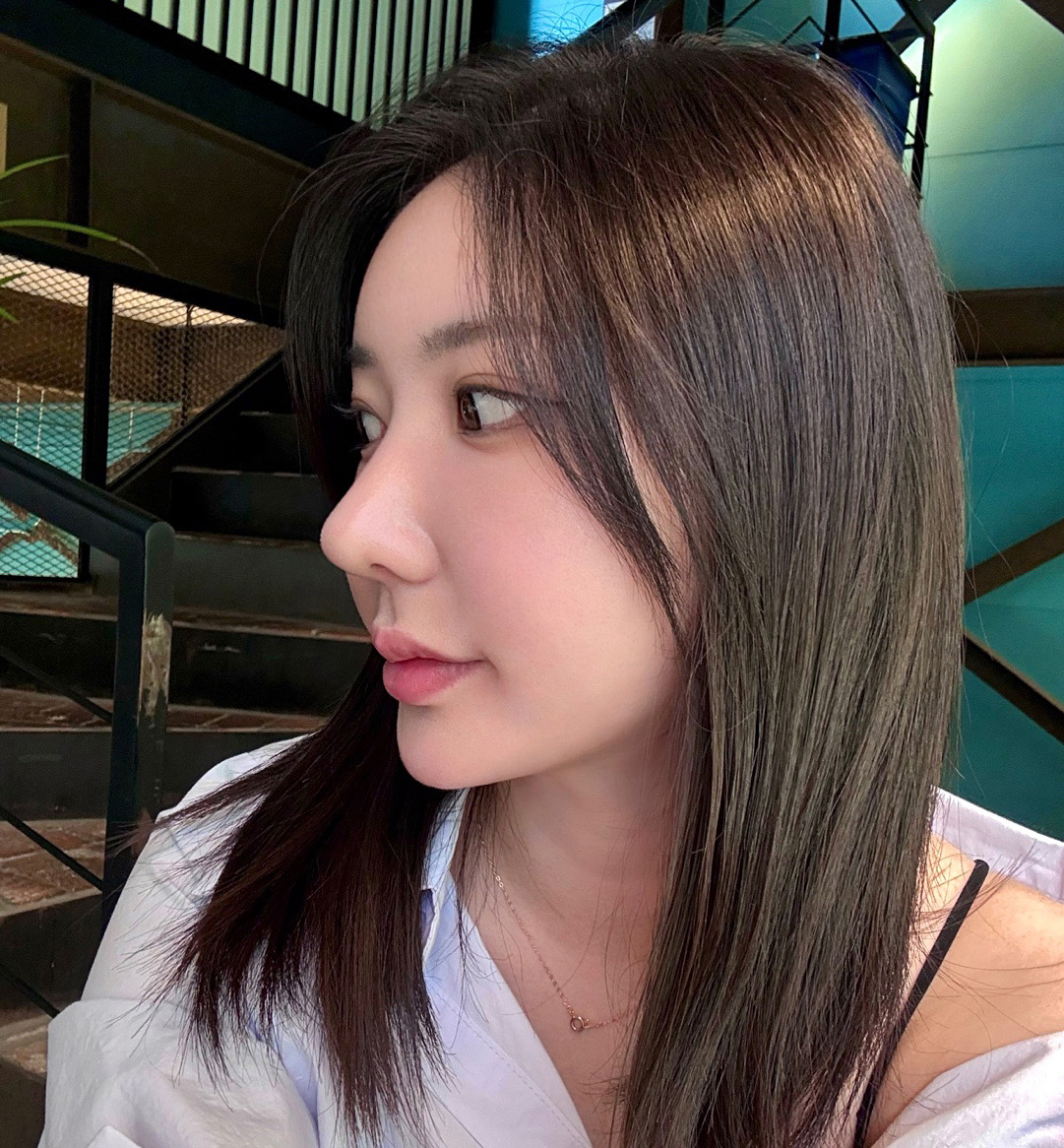 눈, 코, 지방이식 만족후기~~