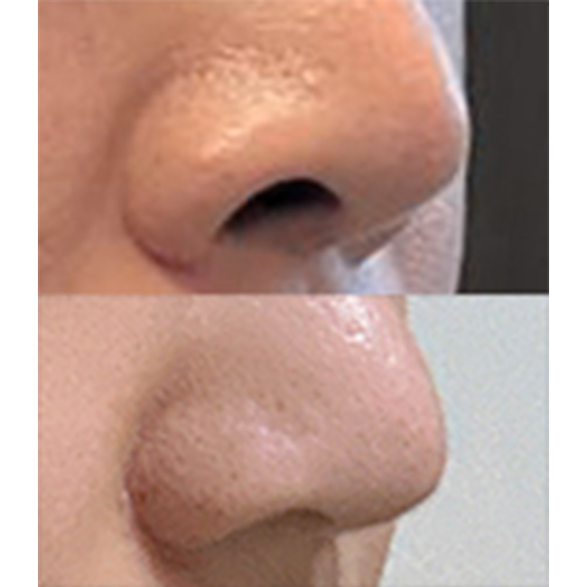 비공내리기는 바이브 추천