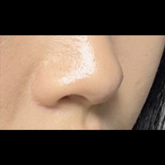 비공내리기 3개월차 ㅎㅎ