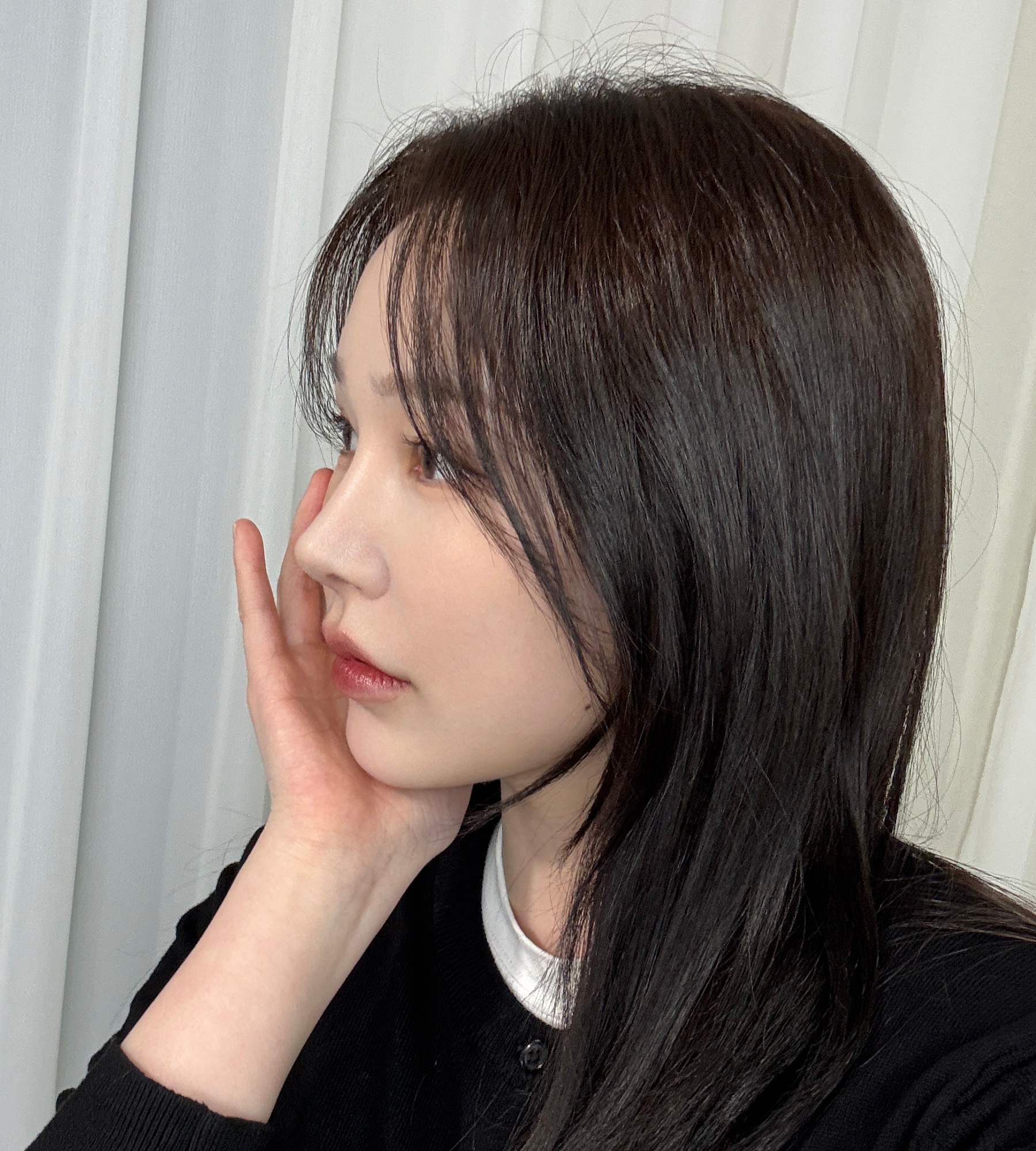 성형 후 이미지가 고급스러워 졌어요~