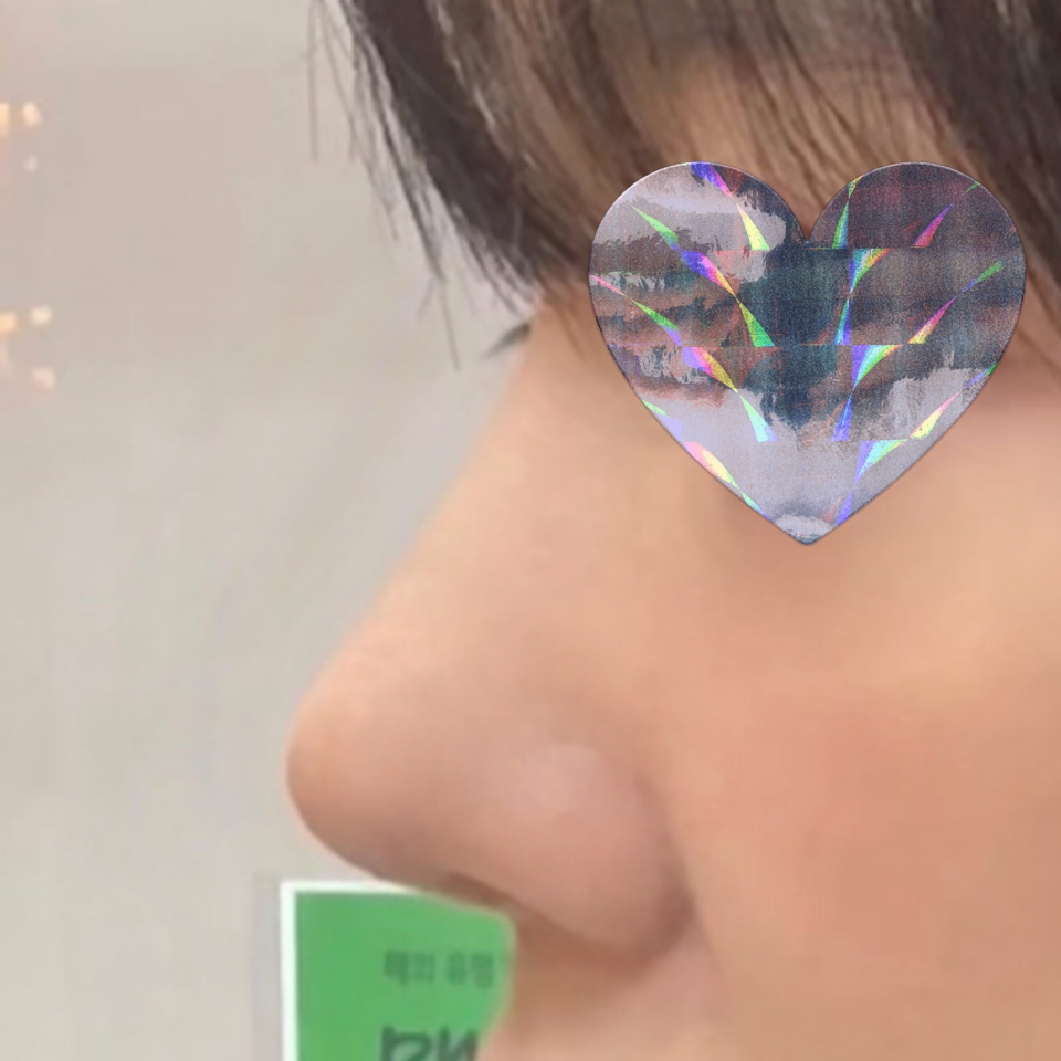 코 예쁘게 만들어주셔서 감사합니당