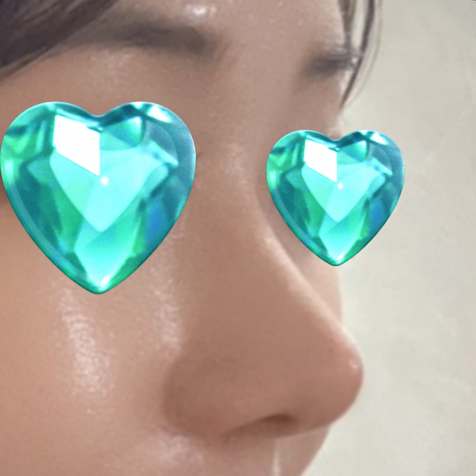 원장님 덕분에 대만족하면서 지내고 있습니당 !!