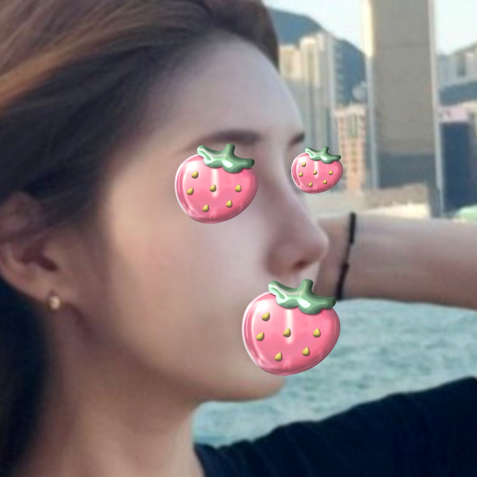 원장님 덕분에 얼굴에 자신감 생겼어요 ㅎㅎ