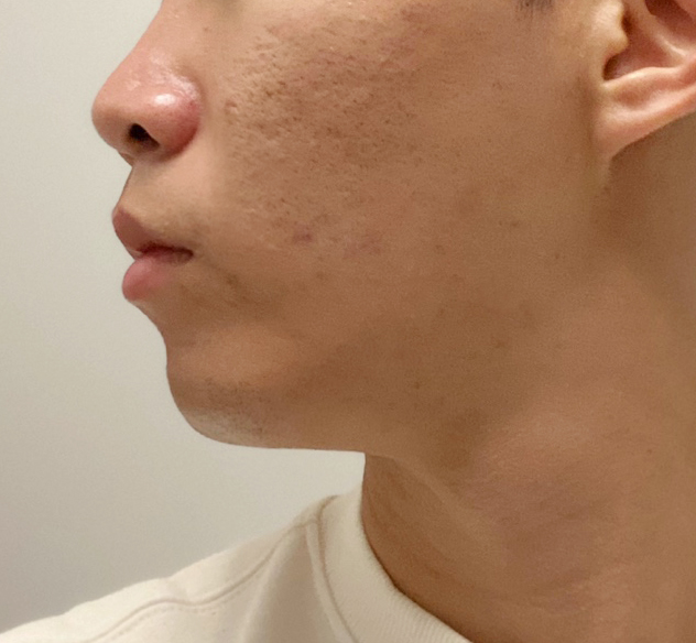 얼지흡 후회노노해요!