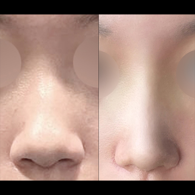 여러각도로 라인 매우 만조꾸 ㅠ!