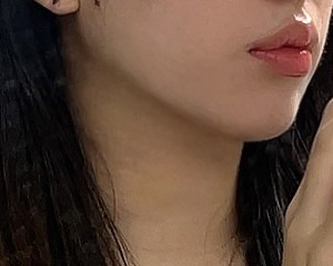 지방흡입 효과 대박입니다!