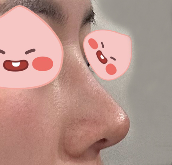 전후차이가 제대로에요!