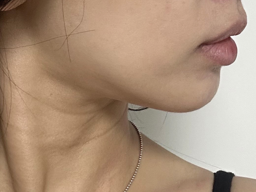 얼굴라인이 잘 정리 되어서 만족합니다