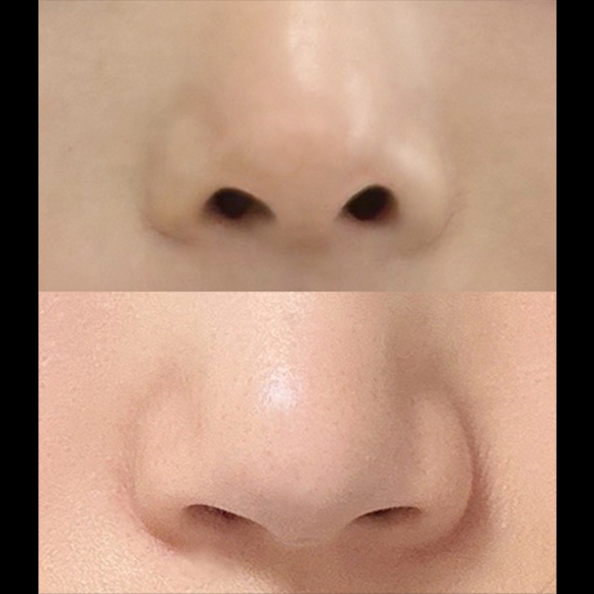 용코고민이라면 바이브 추천이에요!