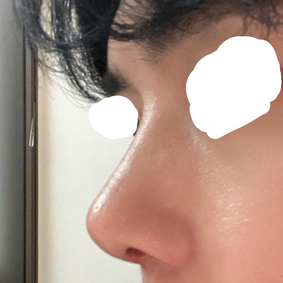 코수술 신의한수 입니다 !