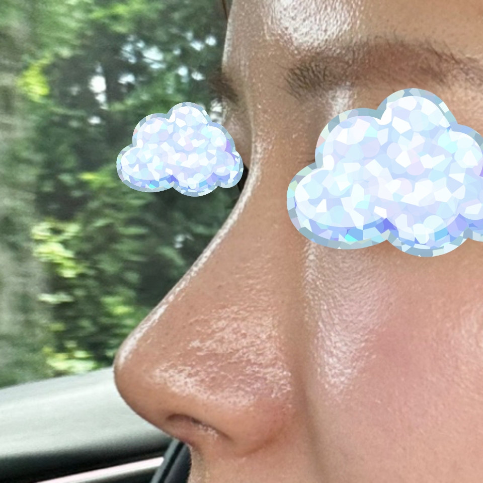 원장님 덕분에 재수술에 성공했습니다