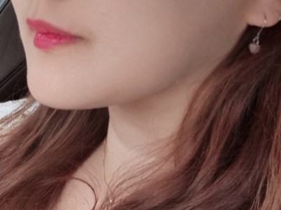 흉터도 안남고 너무 만족스러워용