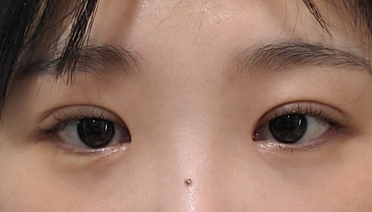 원장님 덕분에 인생 2회차 살고 있어요