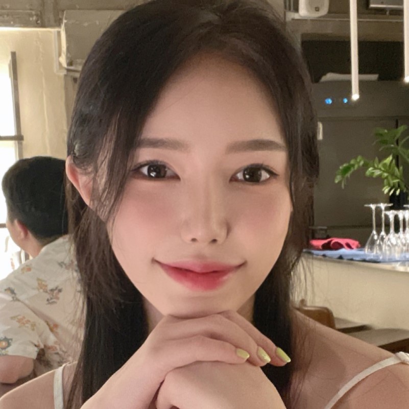 코성형 ,이마거상 수술 4개월차 후기 입니다~!