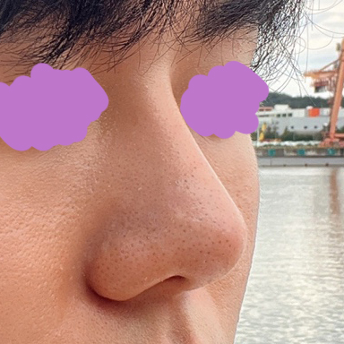 멋진 코 만들어주신 유원장님 감사합니다!