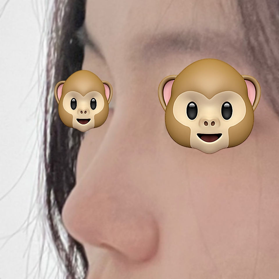 바이브 성형외과 강추입니다 !