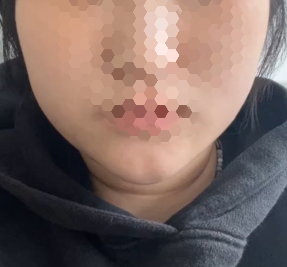 살빠져보인단 소리 많이 들어요