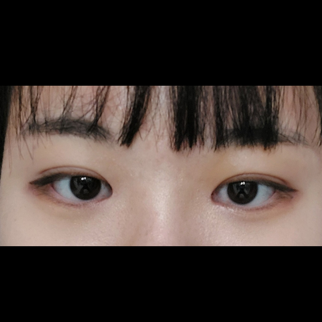 자연 쌍꺼풀 같이 잘됐어욬ㅋㅋㅋㅋ