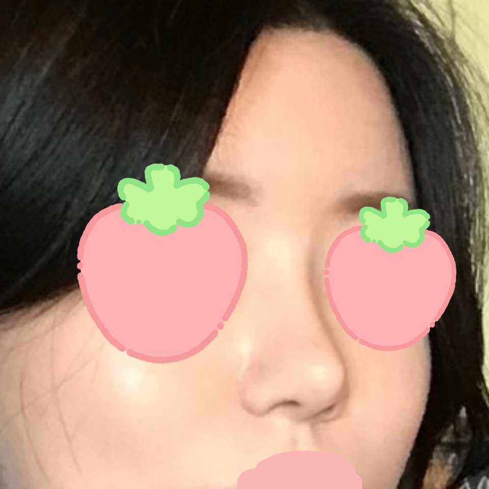 코도 이마라인도 너무 마음에 들어요!