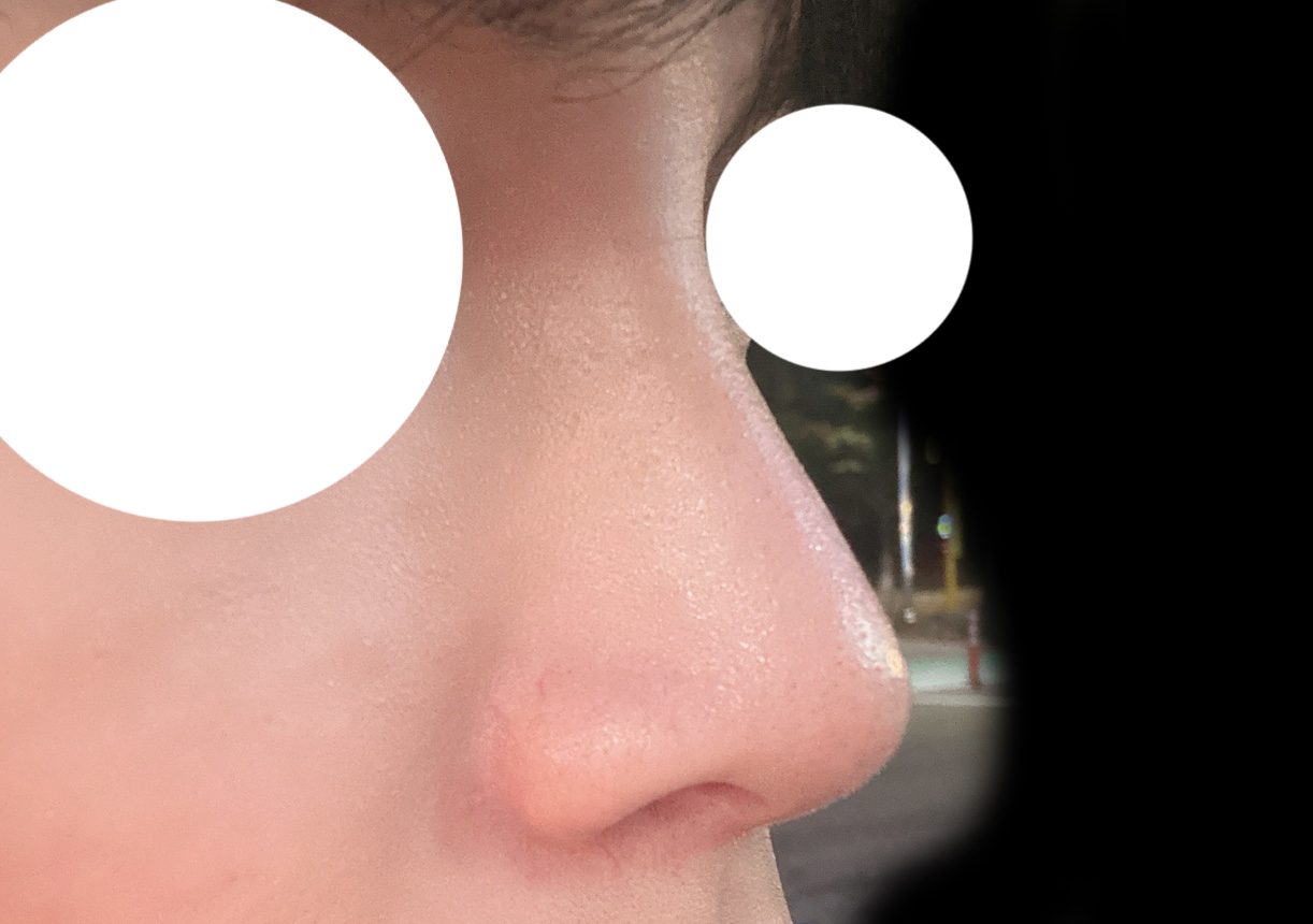 코 너무 만족해서 후기 또써요!