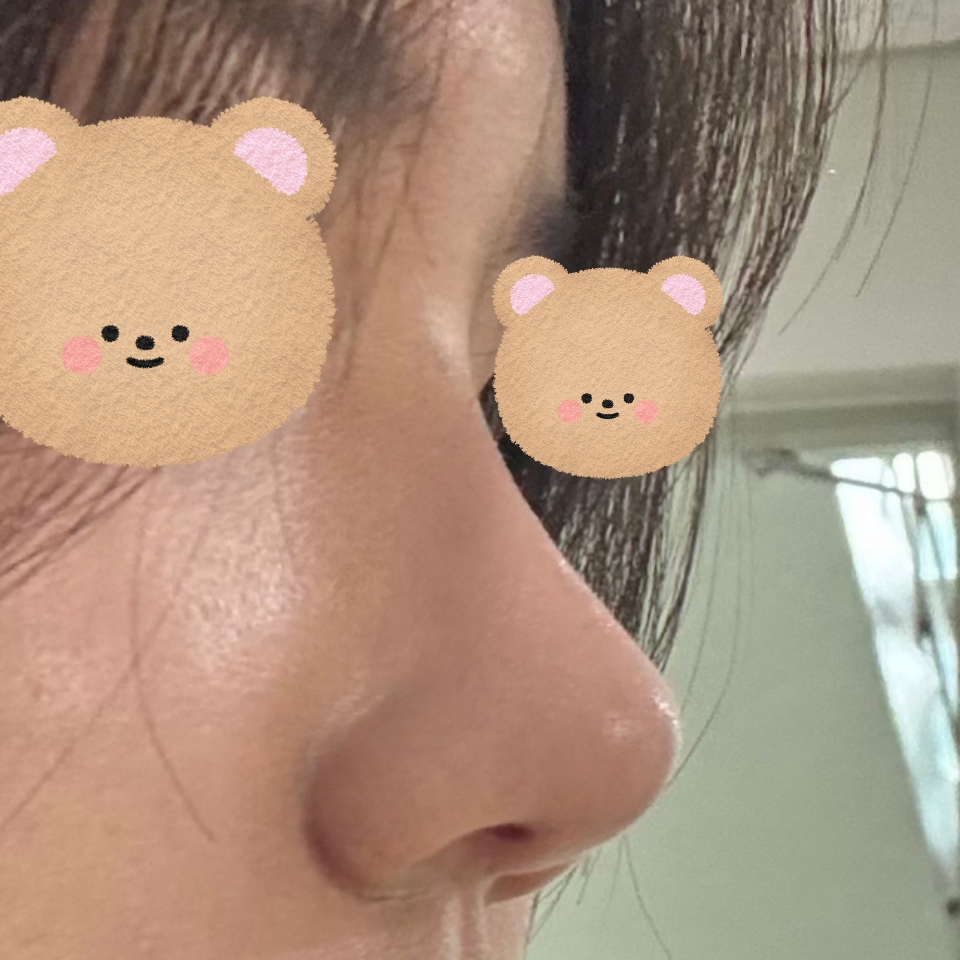 다들 병원 정보 달라고 난리예용