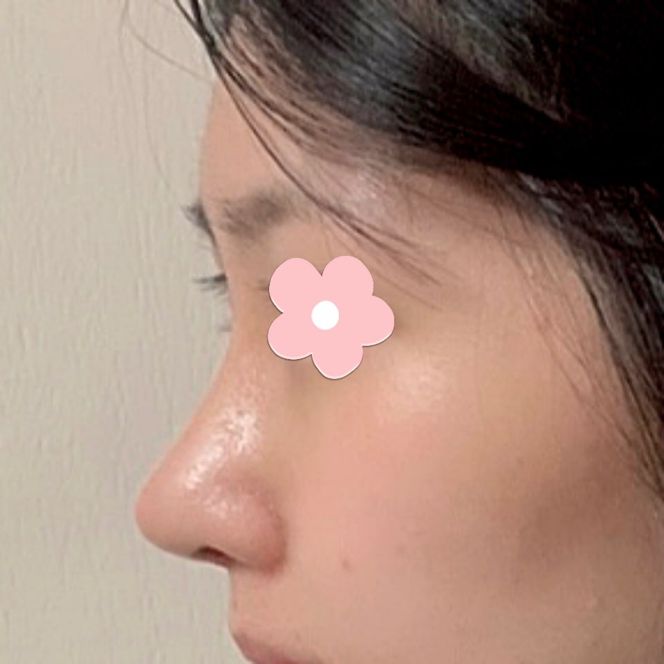 옆모습이 느낌이 확 달라졌어요!