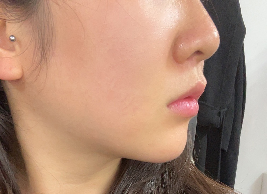 얼지흡 전후차이보세용