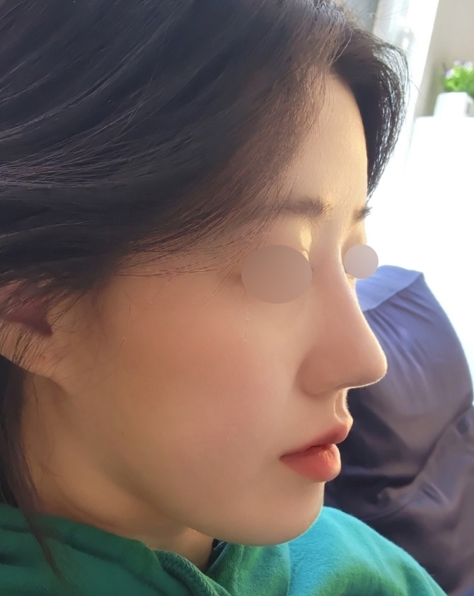 벌써6개월차! 너무만족만족굿