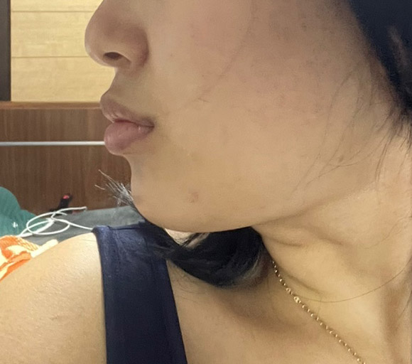 지흡 가성비좋고 효과대박ㅠ