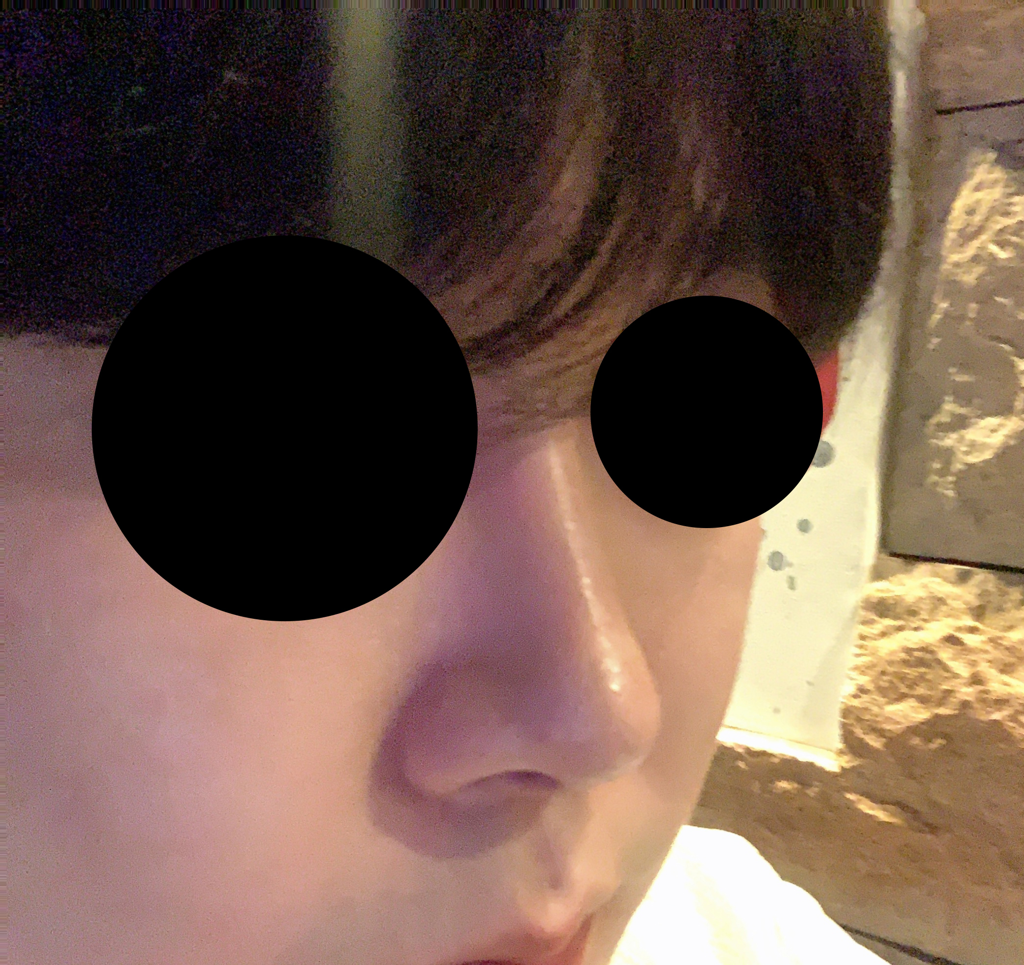 남자코수술 바이브 적극추천드립니다