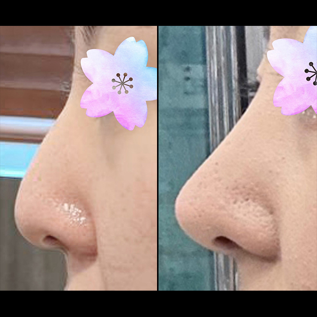 만족도 장난아니에요 ><