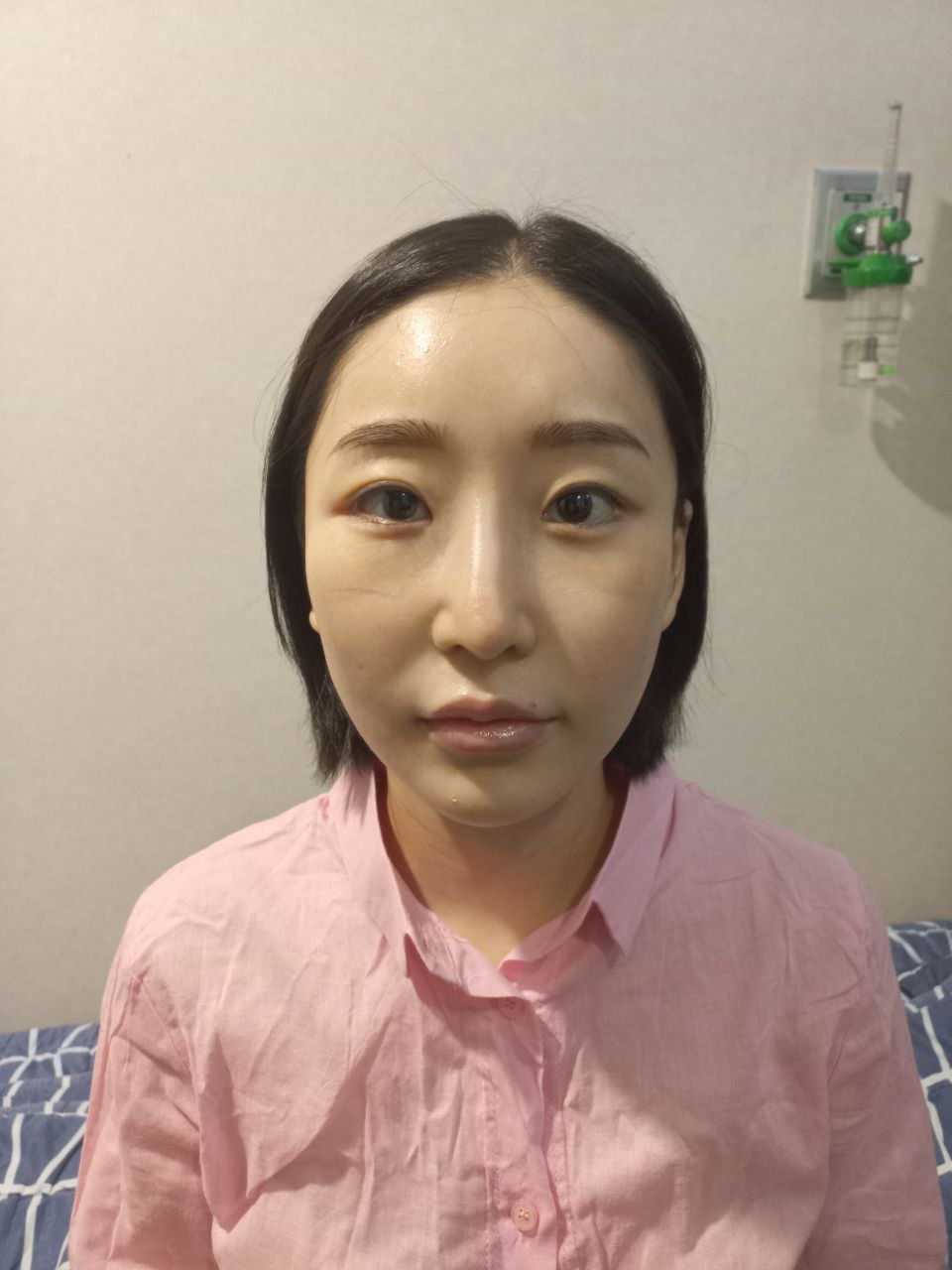 수술전_2_.jpg