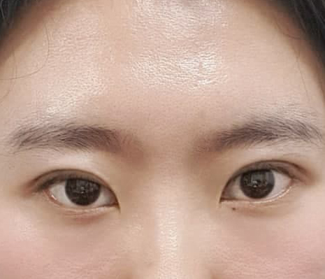 짝눈교정 된것 같나요!!!>.<