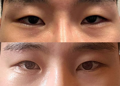 남자 눈썹하거상 후기!