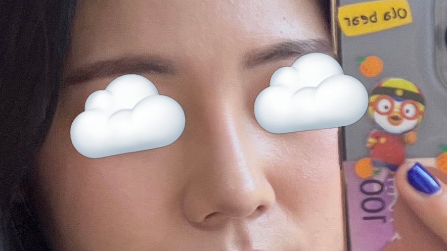 복코교정 너무 잘됐어욤 ㅠ_ㅠ!짱짱