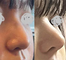 제가 원했던 코로 딱 만들어주셨어요:)