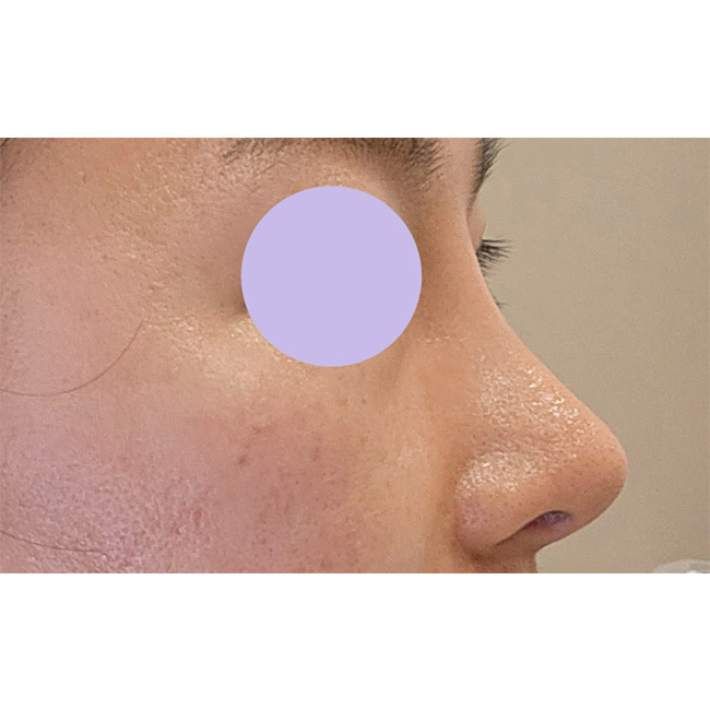 눈, 코 고민하면 바이브추천해요:)