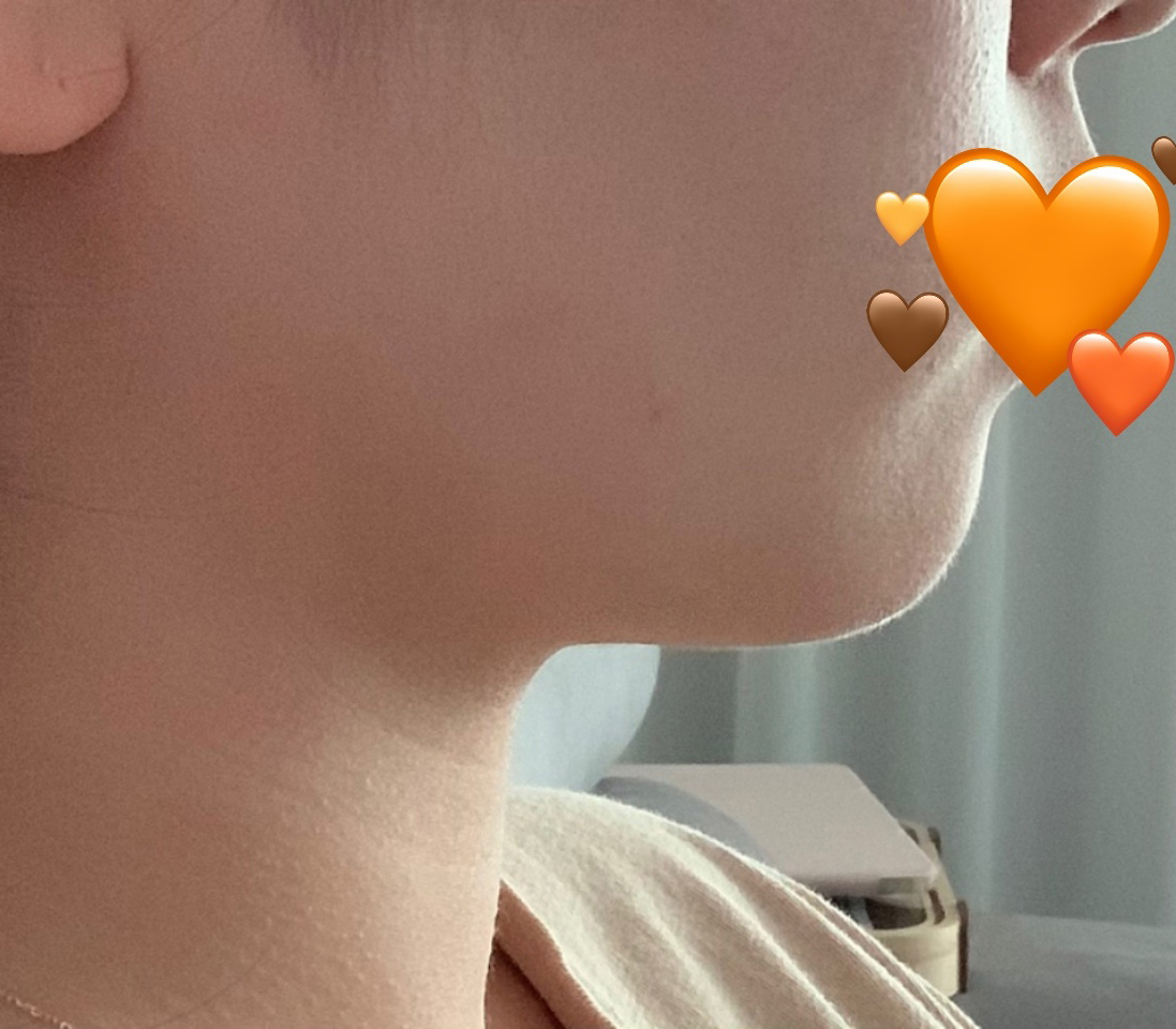 얼지흡하고나서 이중턱 ㅂㅇㅂㅇ