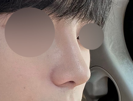 코하고 자신감살아났어요