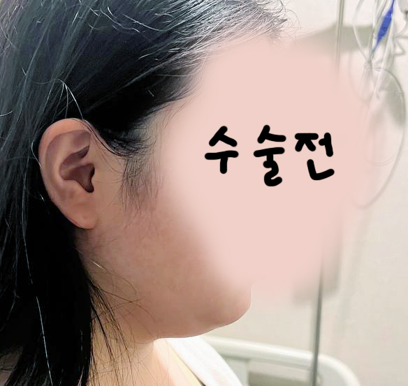 수술전_1_-1.jpg