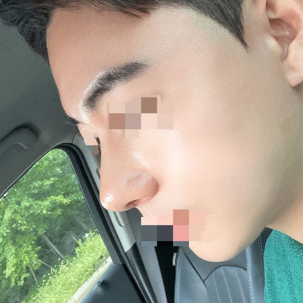 남자코성형알아보시면 바이브 유원장님 찾아가세요!