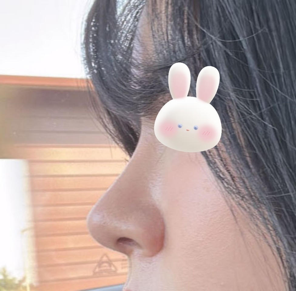 복코교정 넘넘 만족만족~.~