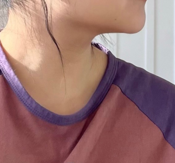 얼지흡하구 턱 자연스럽게 갸름갸름해졌어용