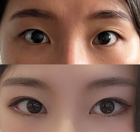 눈 정말 잘됐어요