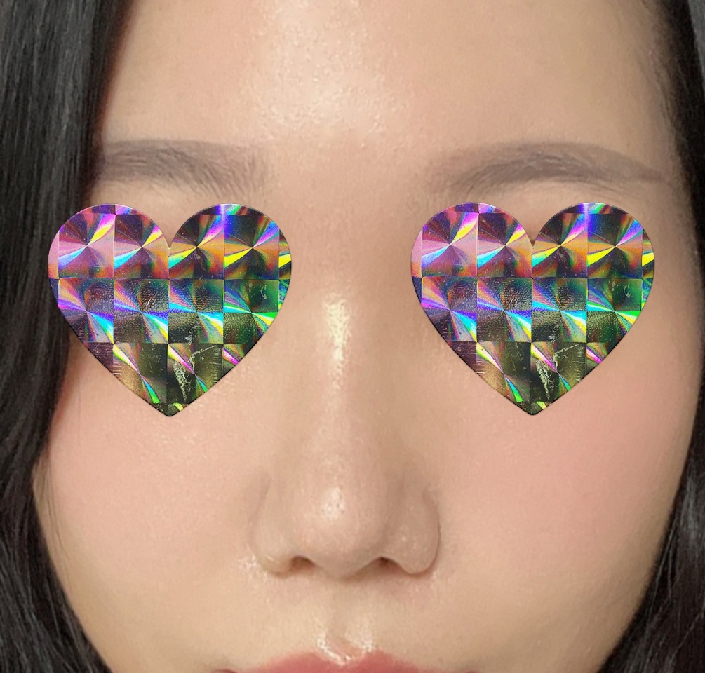 주먹코, 복코 고민 끝낸 후기!!