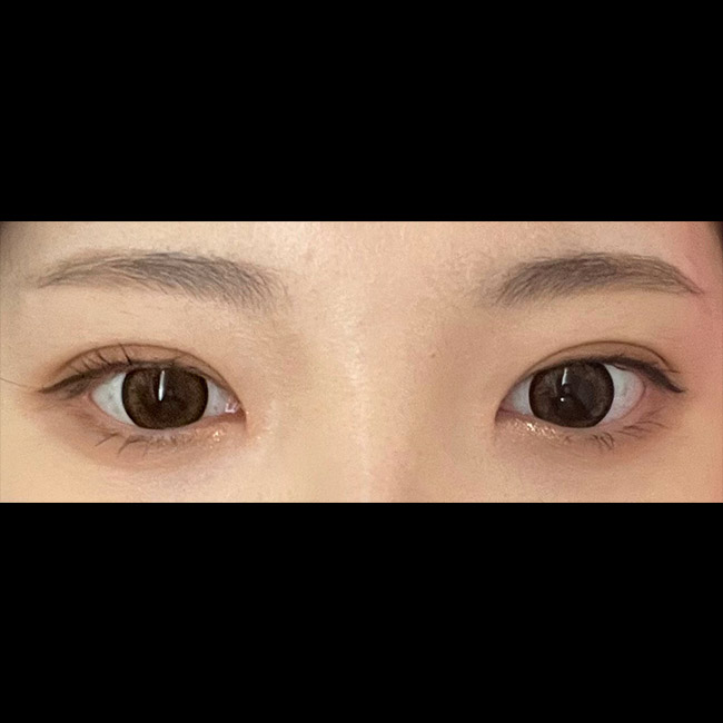 눈하구 삶의질올랐어요 ㅠㅠ!!