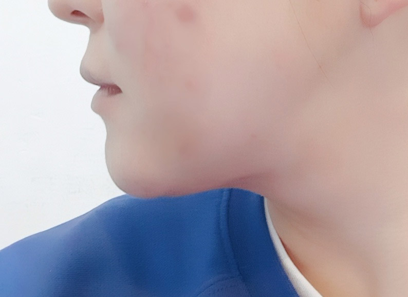 지흡하고 갸름갸름