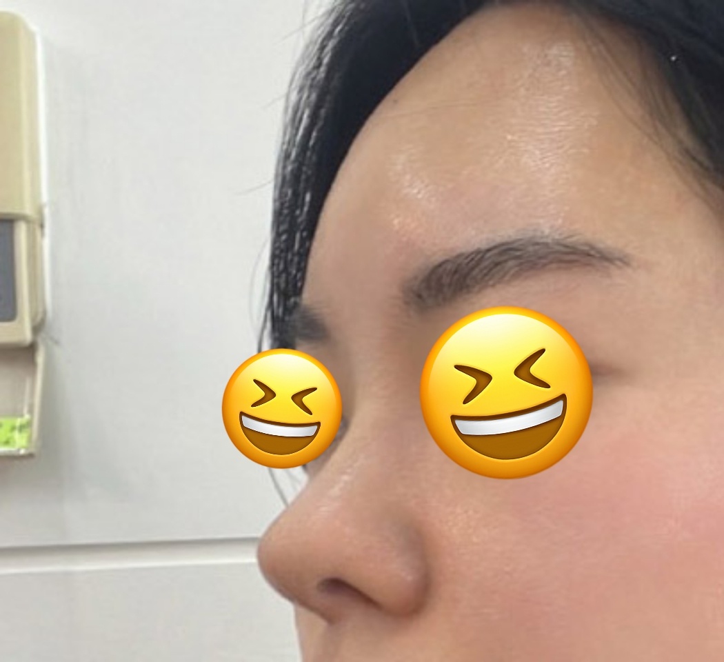 왜 코성형잘한다고 하는지 알겠어요