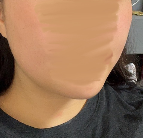 끝장지흡 효과 지대로봄